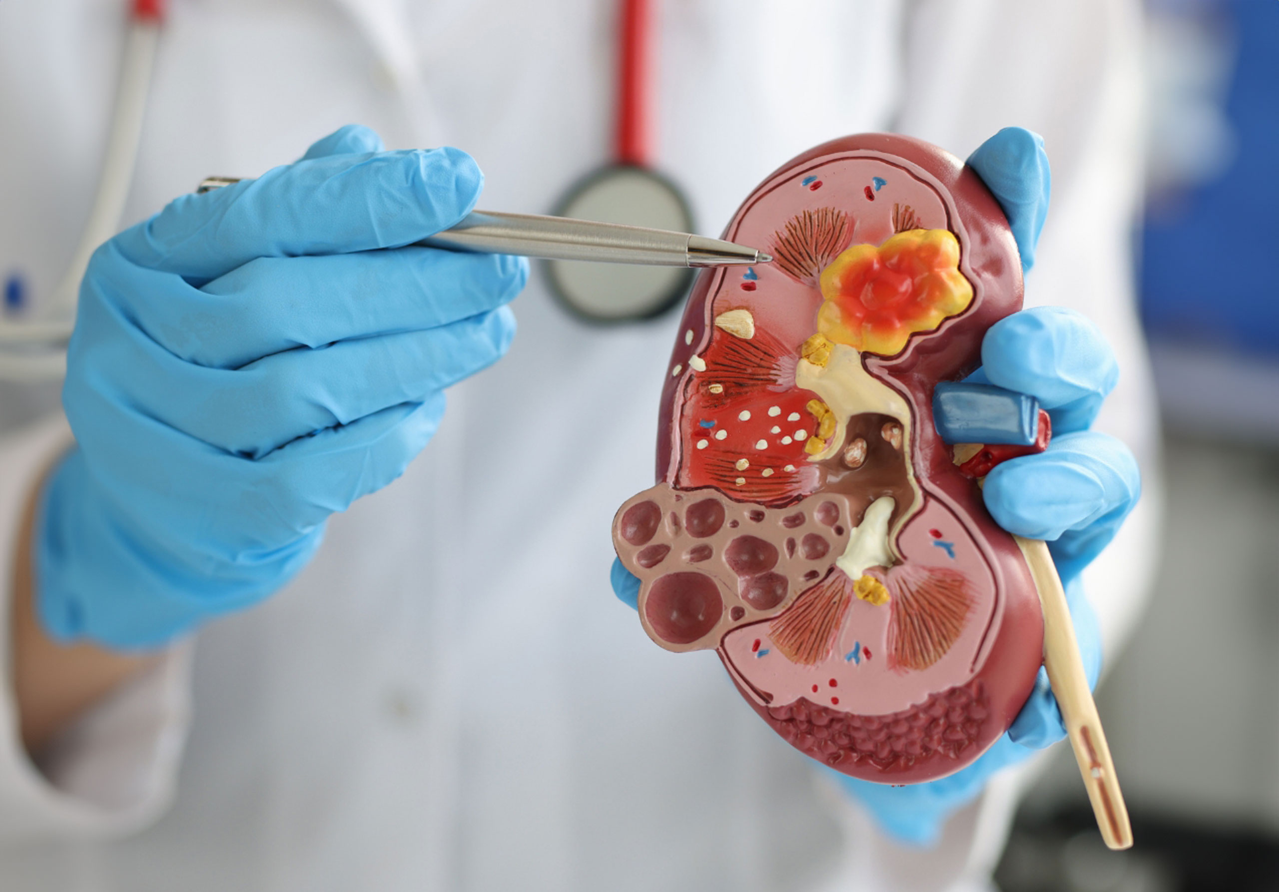 Urologia e Endocrinologia